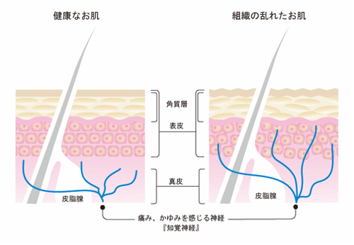 C線維（痛みを伝える神経）